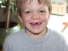 Trey right after he lost his front tooth!